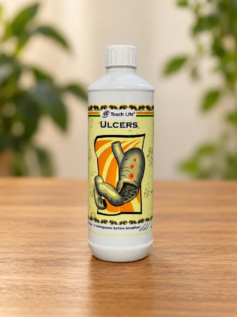 Ulcer Front.webp