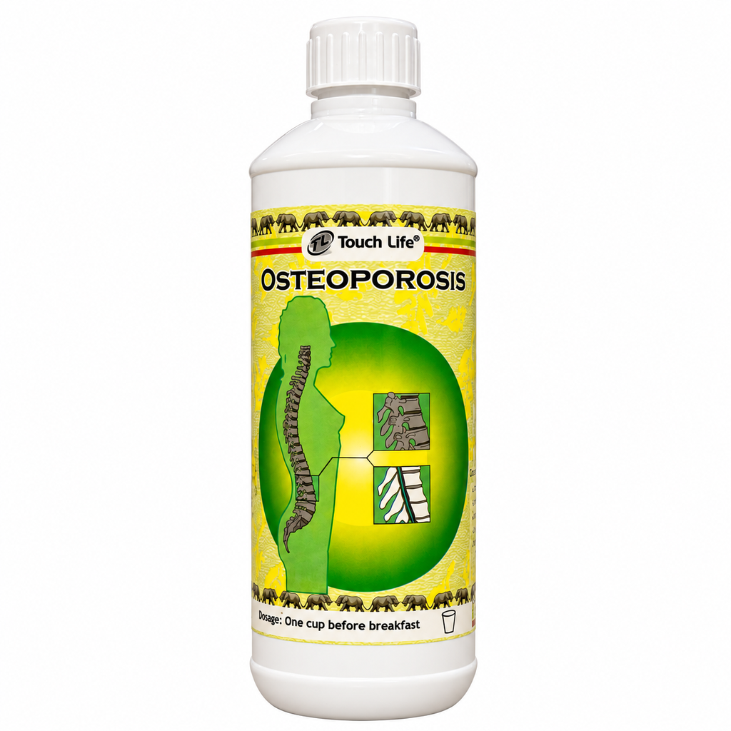 [OSTEO] OSTEOPOROSIS