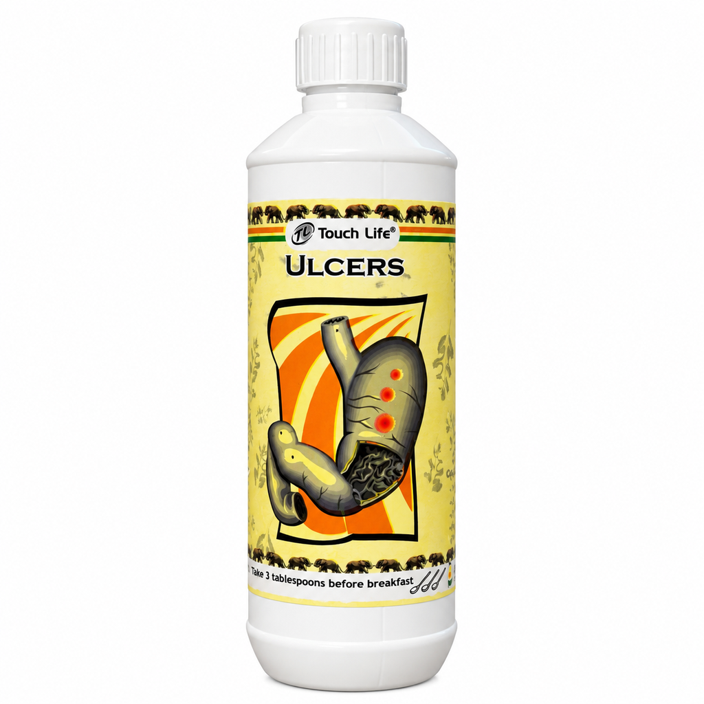 [ULC] ULCER